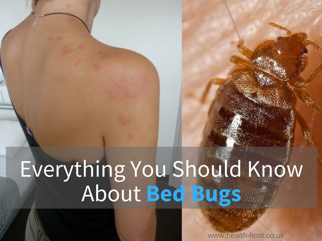 how-long-do-bed-bites-last
