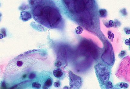 herpes virus