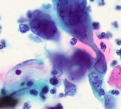 herpes virus