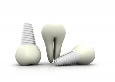 tooth implant tips