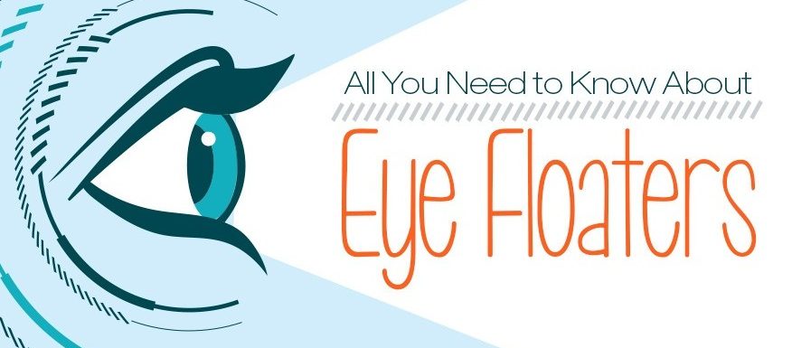 What are Eye Floaters