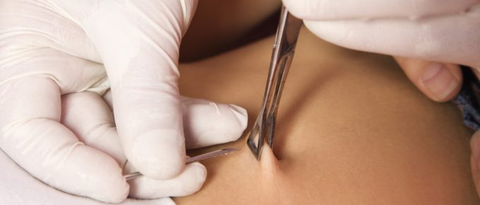 piercing-hygiene